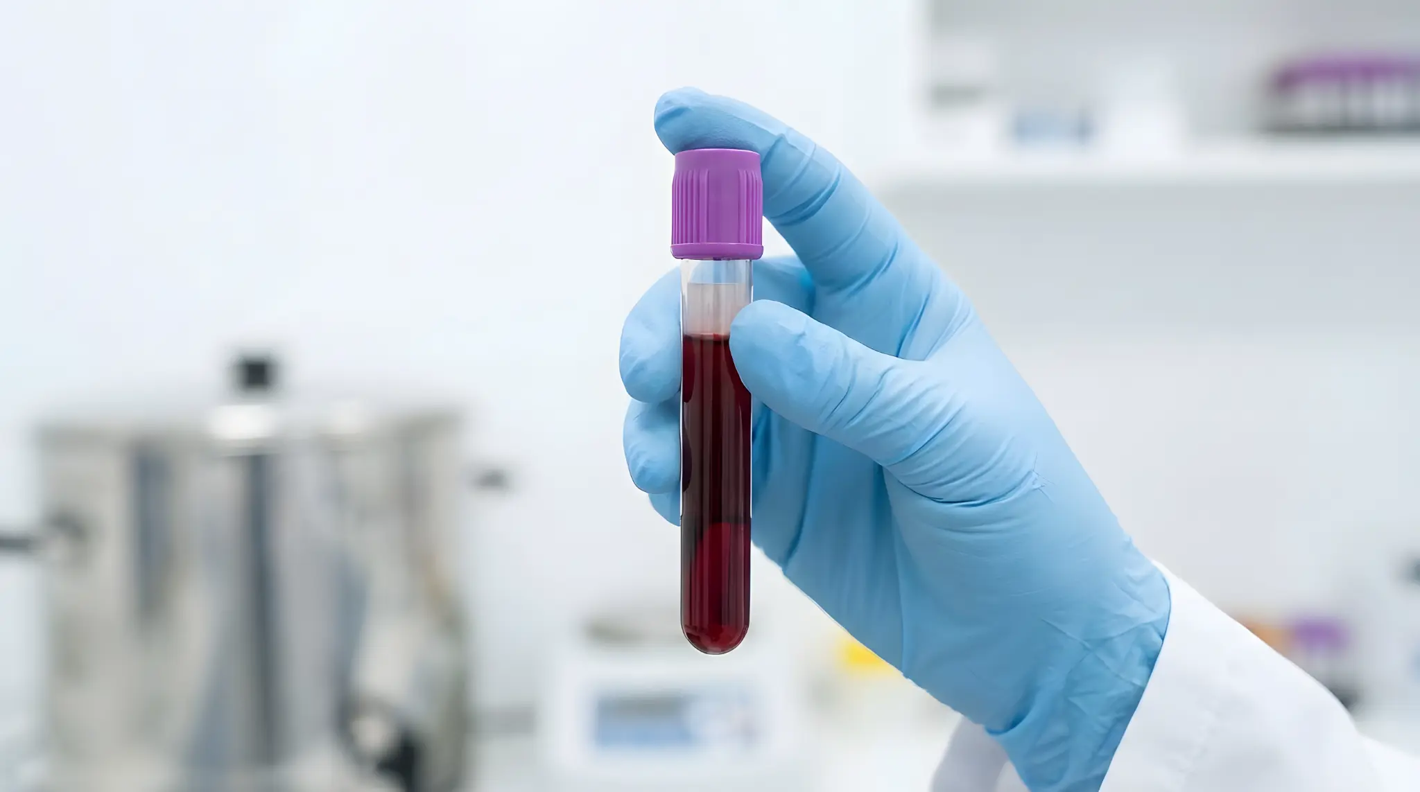 NIPT検査に使用される採血管